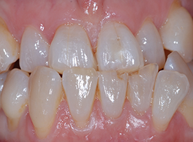 Before Treatment